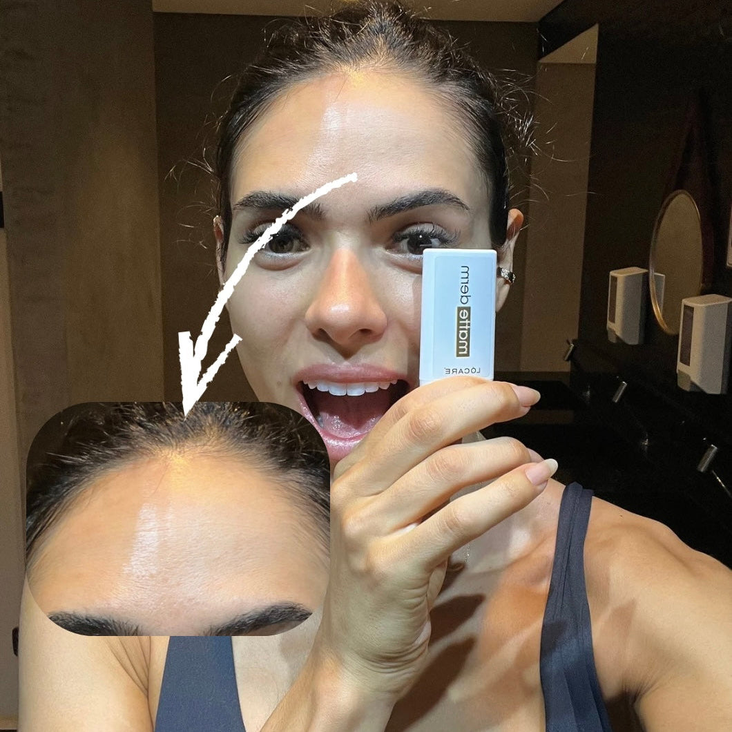 Matte Derm - Bastão Antioleosidade 15g - Lócare®